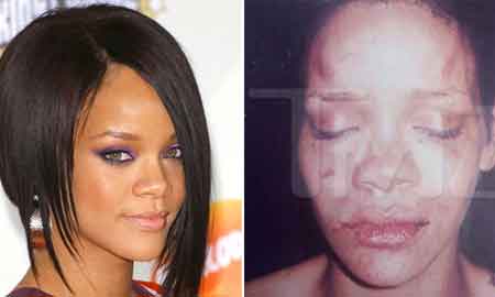 20091026171016-rihanna-golpeada-por-chris-brown-hip-hop.jpg